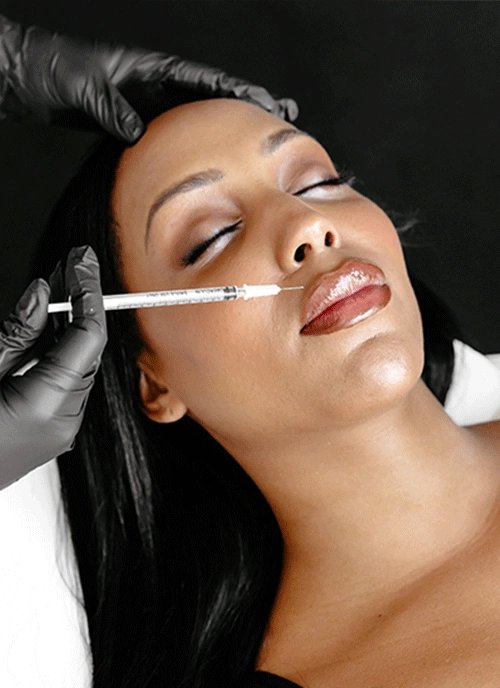 Dermal Fillers
